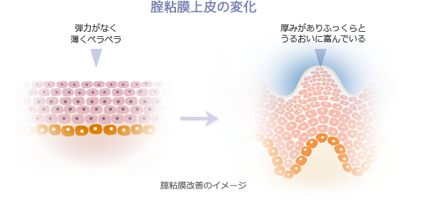 モナリザタッチの効果