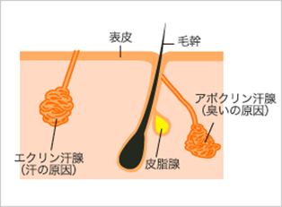 ワキガ・多汗症